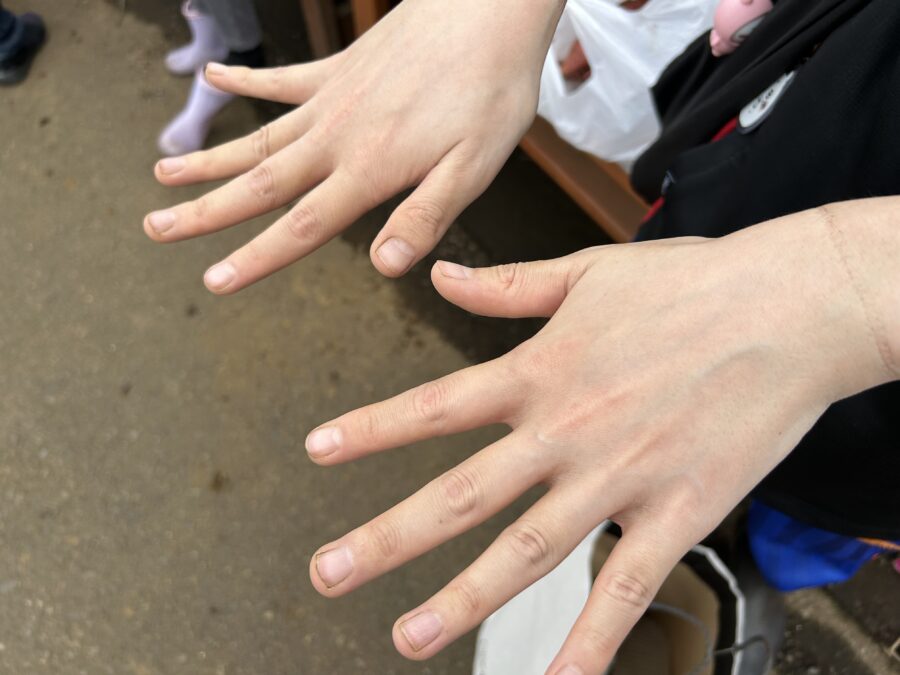 汚れた手